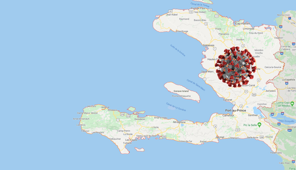 Haïti confirme son 21ème cas de coronavirus dont 14 dans l’Ouest